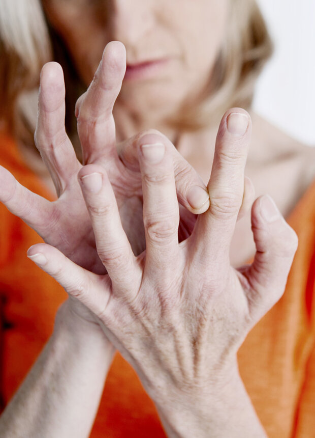 Qué significa tener artritis reumatoide